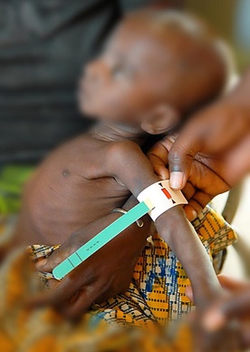 183774_worldvision_muac_7