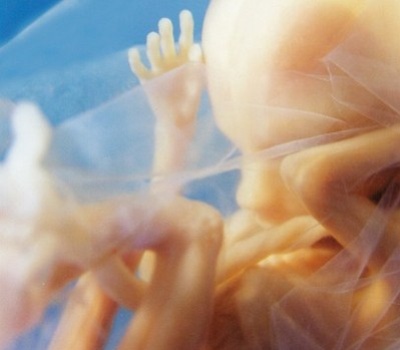 dziecko_3i5_miesiace_prolife-400x0