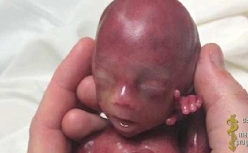 holdingbabieshead-cmpvideo6-854px_810_500_55_s_c1