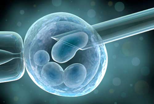 in-vitro-fertilization