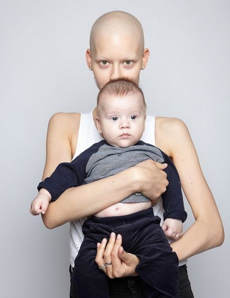 jaw-cancer-model-11