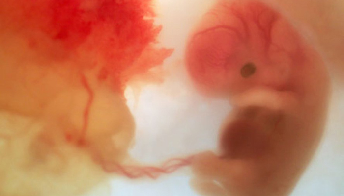 phototake_photo_of_8_week_fetus-960x600