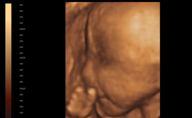 3d_ultrasound_810_500_55_s_c1