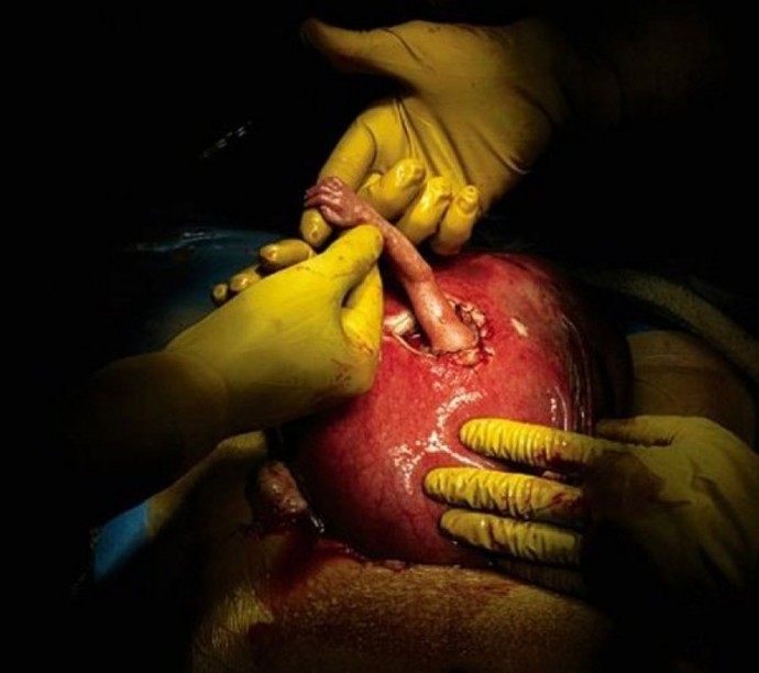 handofhope02-690x612