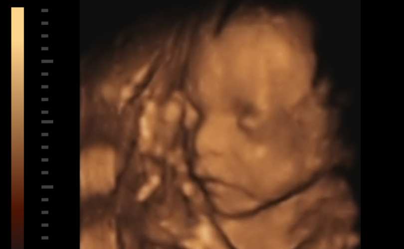 3d_ultrasound_810_500_55_s_c1