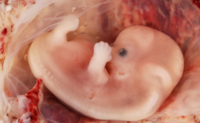 4weekoldunbornbaby