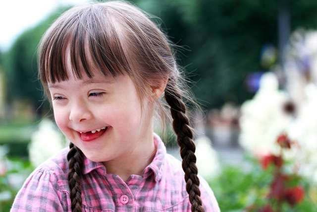 girl_with_down_syndrome_credit_denis_kuvaev_via_wwwshutterstockcom_cna_12_10_15