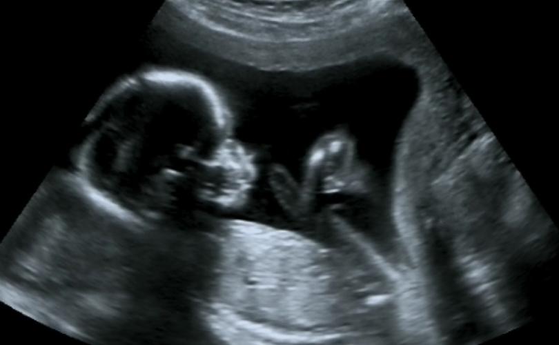 dismember_abort_810_500_75_s_c1