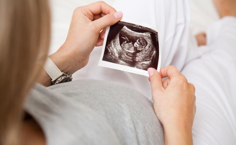 pregnant_ultrasound_810_500_75_s_c1