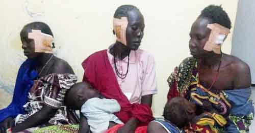 boko_maimed_women