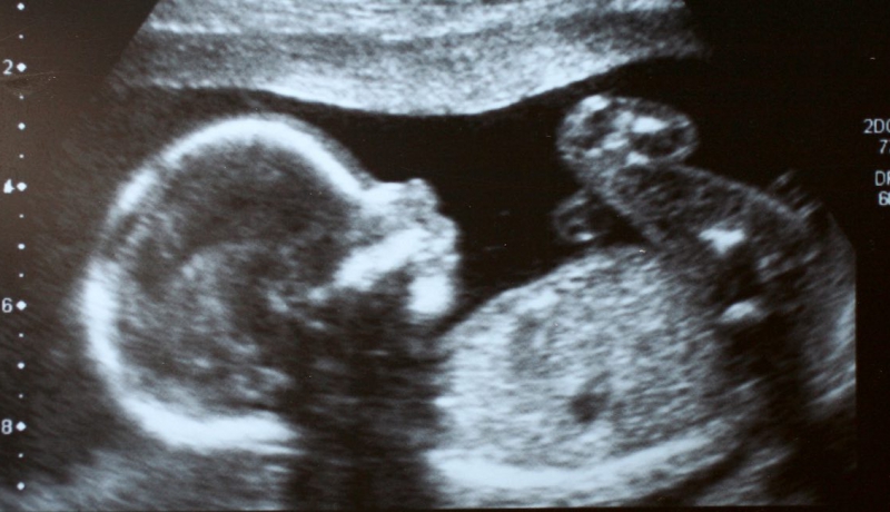 aborcja-1