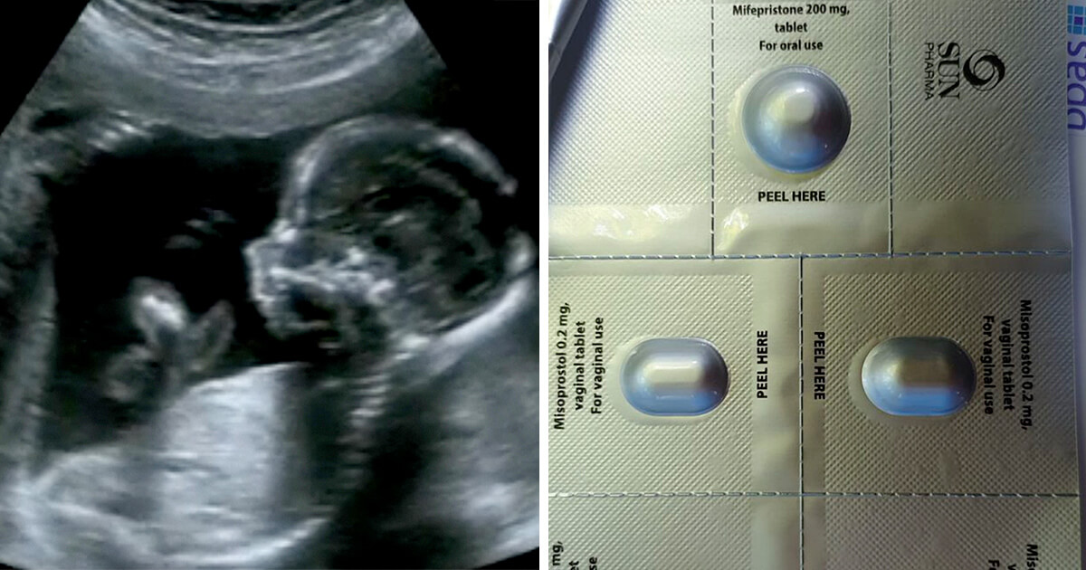 baby_abortion