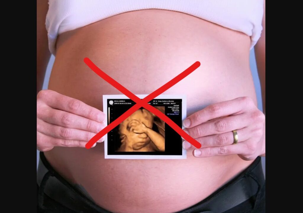 abortion_up to birth
