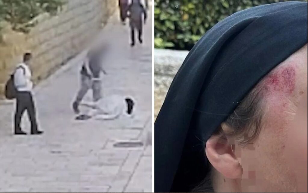 nun atacked